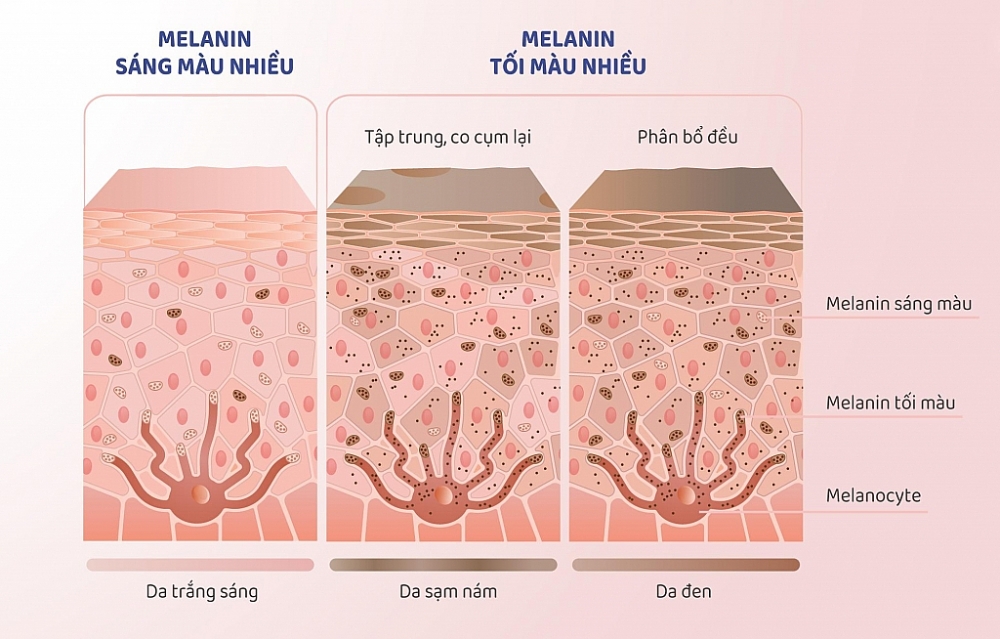 Melanin tác động đến màu da như thế nào?