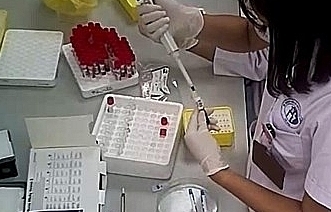 Đã có kết quả ban đầu vụ cắt đôi que thử HIV tại BV Đa khoa Xanh Pôn