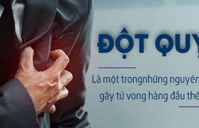 Chuyên gia lý giải vì sao đột quỵ tăng nhanh ở người trẻ